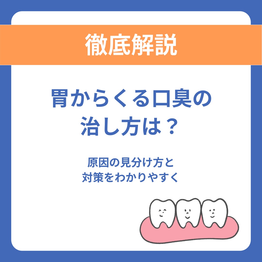 胃からくる口臭の治し方は？